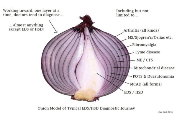 Omg omgruzxpnew4af onion com